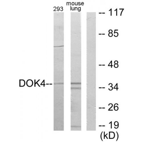 Docking Protein 4 (DOK4) Antibody