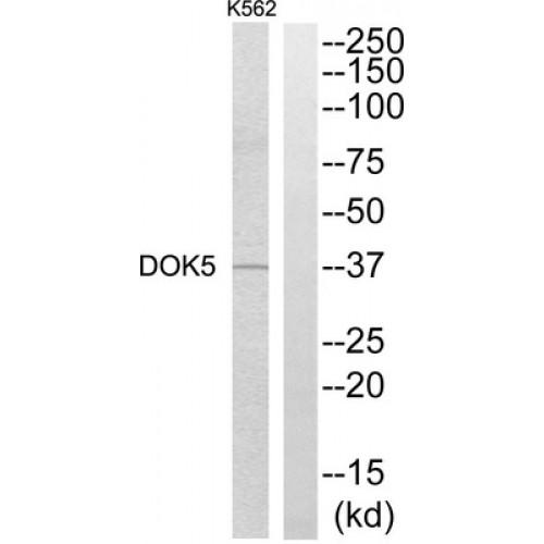 Docking Protein 5 (DOK5) Antibody