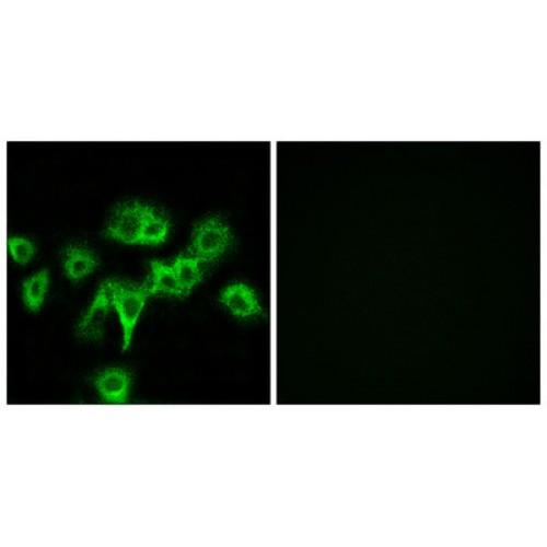 Cell Adhesion Associated, Oncogene Regulated (CDON) Antibody