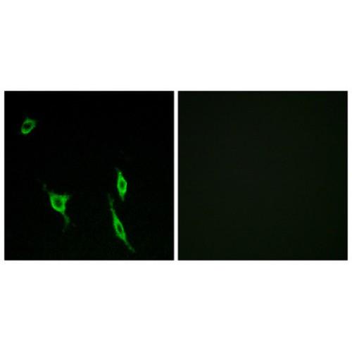 Netrin Receptor DCC (DCC) Antibody