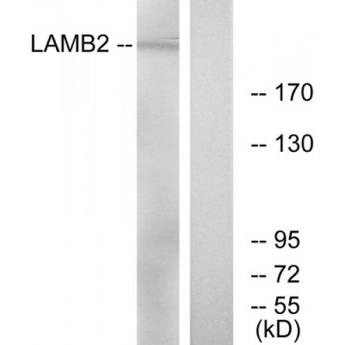 Laminin, Beta 2 (LAMB2) Antibody