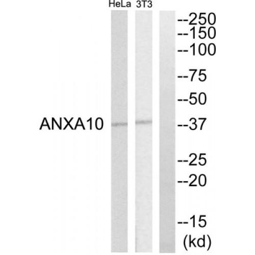 Annexin A10 (ANXA10) Antibody