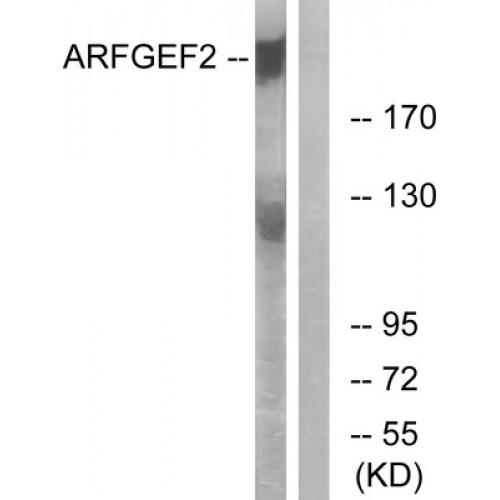 ADP Ribosylation Factor Guanine Nucleotide Exchange Factor 2 (ARFGEF2) Antibody
