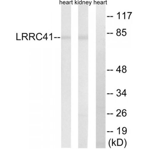 Leucine Rich Repeat Containing 41 (LRRC41) Antibody