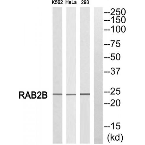 RAB2B, Member RAS Oncogene Family (RAB2B) Antibody