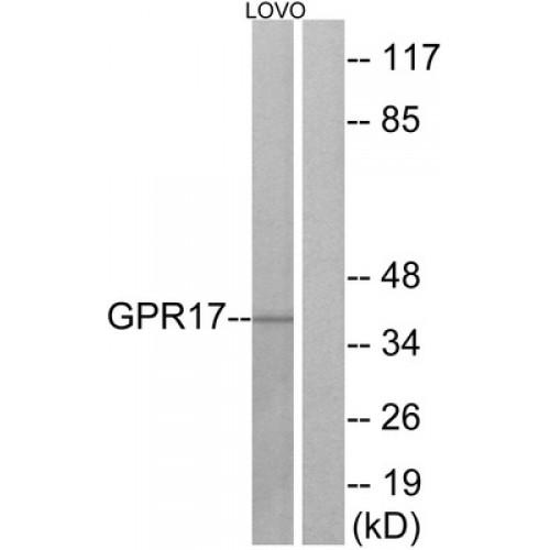 Uracil Nucleotide/Cysteinyl Leukotriene Receptor (GPR17) Antibody