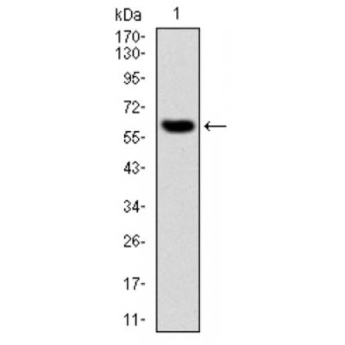 Matrix Metalloproteinase 3 / Stromelysin-1 (MMP3) Antibody