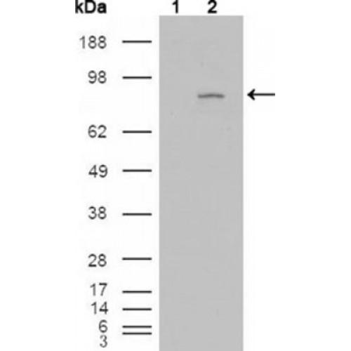 Fibroblast Growth Factor Receptor 4 (FGFR4) Antibody