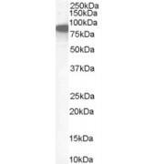 Ezrin (EZR) Antibody