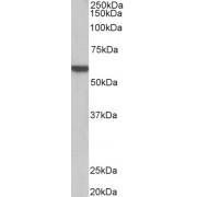 Alpha 1B Adrenergic Receptor (ADRA1B) Antibody