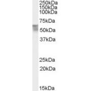 Thyroid Hormone Receptor Alpha (THRA) Antibody