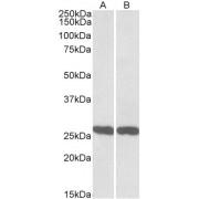 Ubiquitin Carboxyl Terminal Hydrolase L1 (UCHL1) Antibody