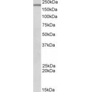 DENN Domain-Containing Protein 4c (Dennd4c) Antibody