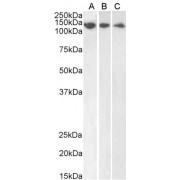 Damage Specific DNA Binding Protein 1 (DDB1) Antibody