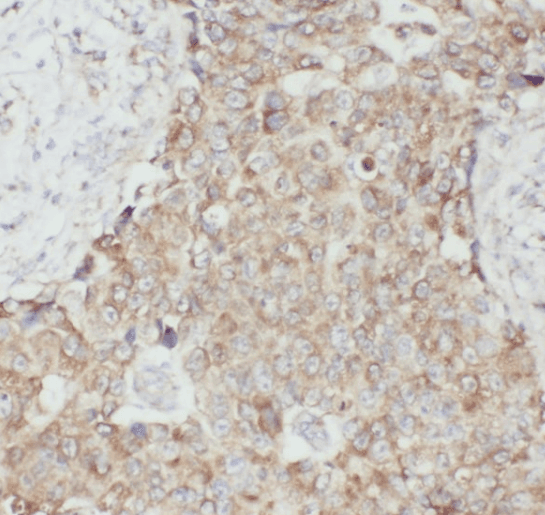 anti- 14-3-3 GAMMA-Specific antibody