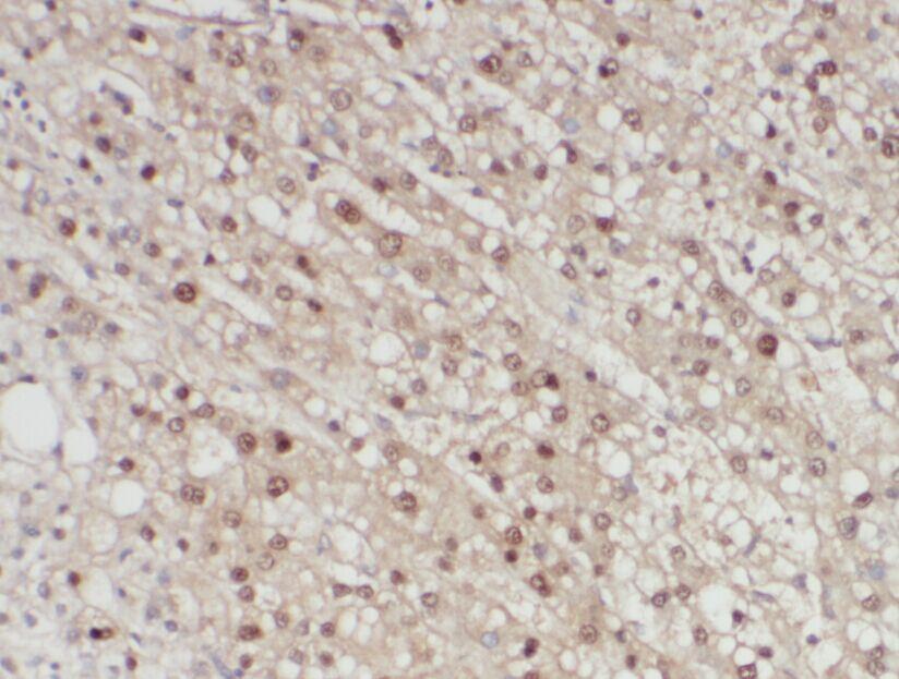 anti- A1BG antibody