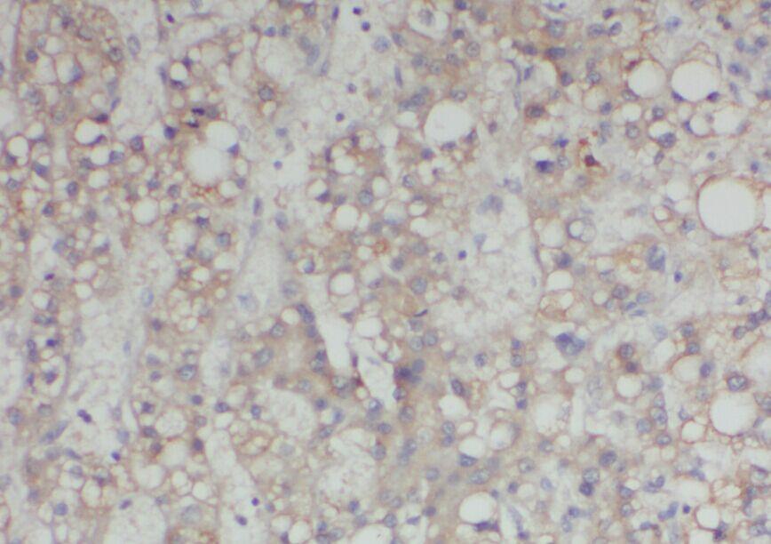 anti- AADAT antibody