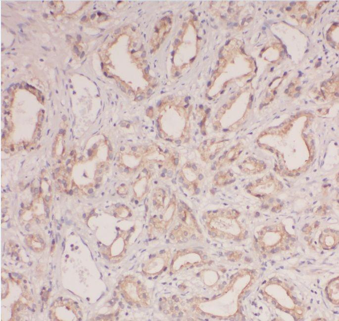 anti- ABHD14B antibody