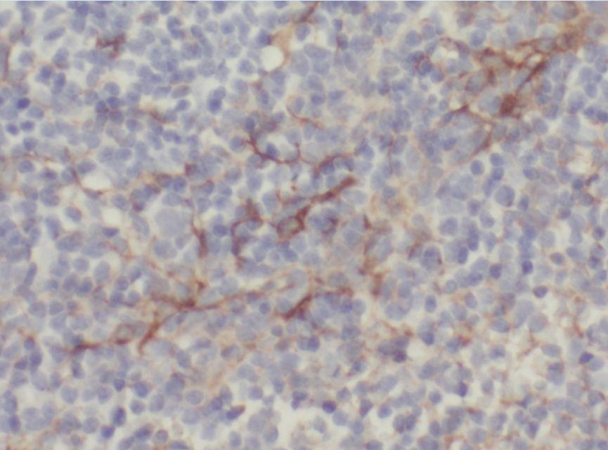 anti- ABHD2 antibody