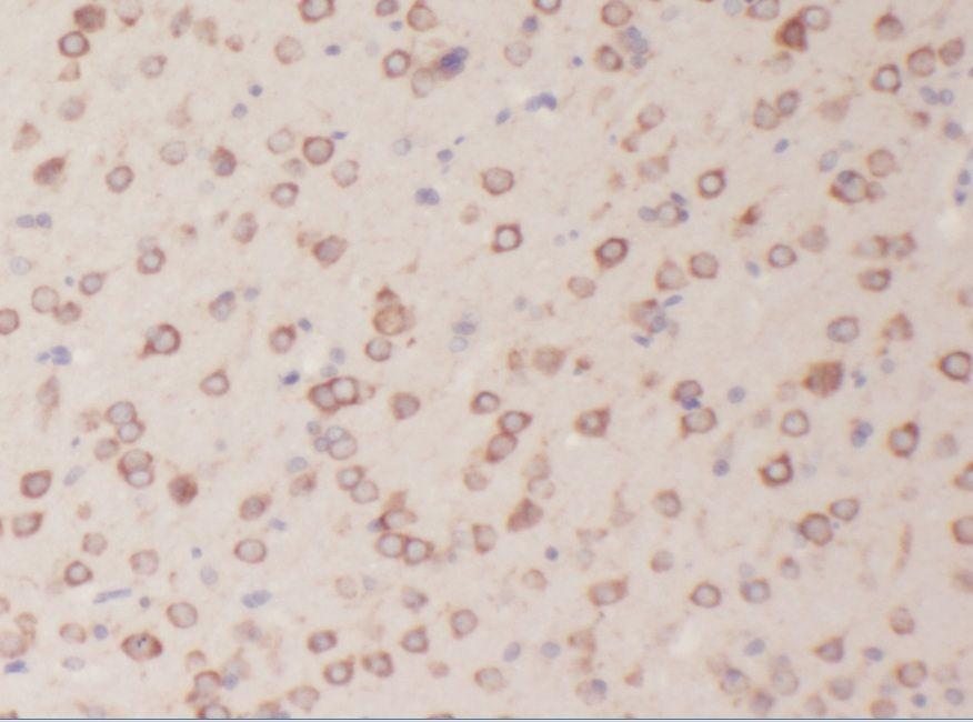 anti- ABI2 antibody