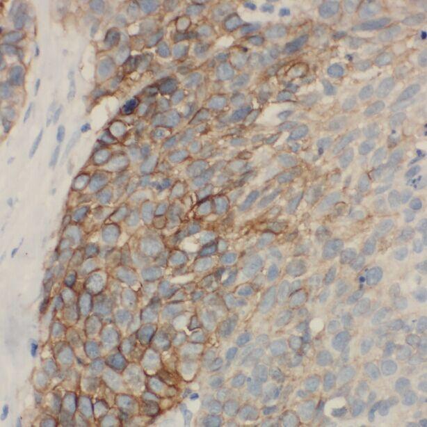 anti- ACAA2 antibody