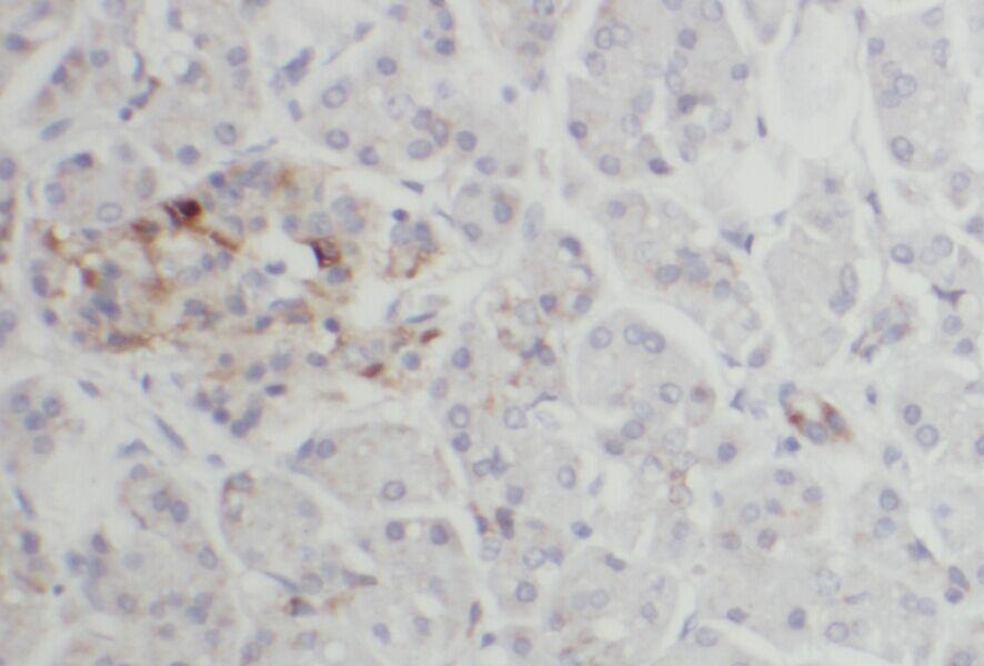 anti- ACAD10 antibody