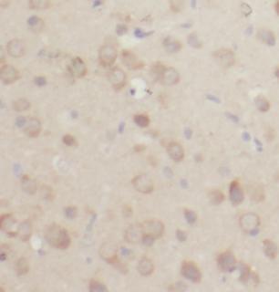 anti- ACOT7 antibody