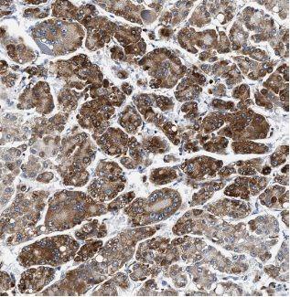 anti- ACSL1 antibody