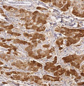 anti- ACSM5 antibody