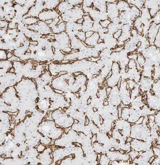 anti- ACTA2/smooth muscle actin antibody