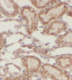 anti- ADH4 antibody