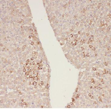 anti- ADHFE1 antibody