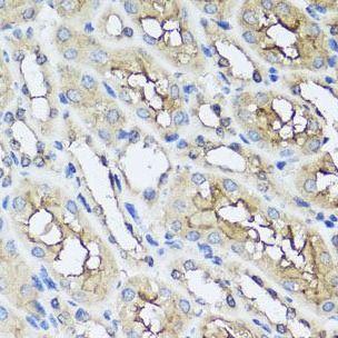 anti- AIP/ARA9 antibody