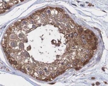 anti- ALDH1A1 antibody