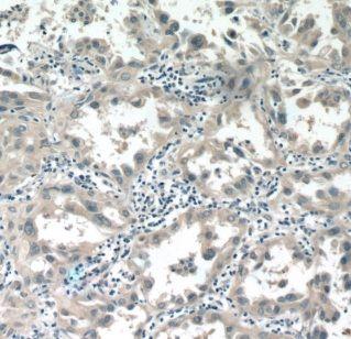 anti- ALDH3B1 antibody