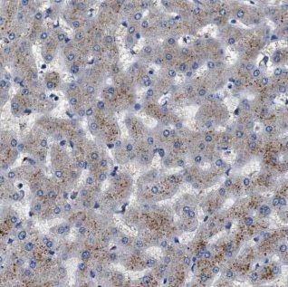 anti- ALDH5A1 antibody