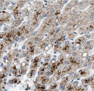 anti- ALPK1 antibody