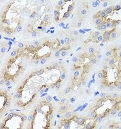 anti- AMBRA1 antibody