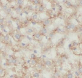 anti- Annexin A2 antibody