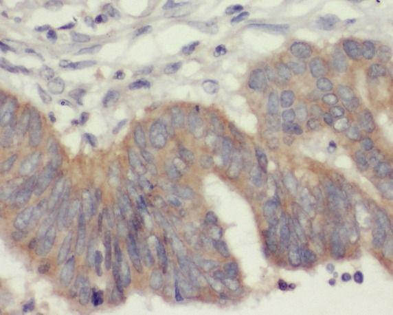 anti- Annexin VI antibody