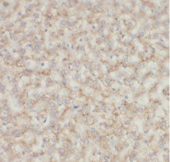 anti- C1QC antibody