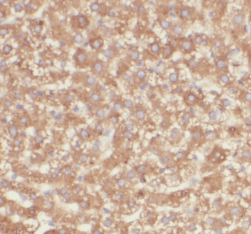 anti- C4(alpha chain) antibody