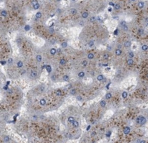 anti- C4(gamma chain) antibody