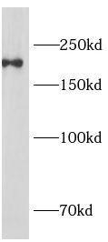 anti- CD11B/Integrin alpha M antibody