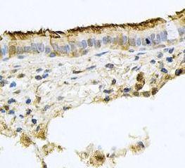 anti- CD133 antibody