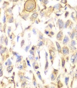 anti- CD151 antibody