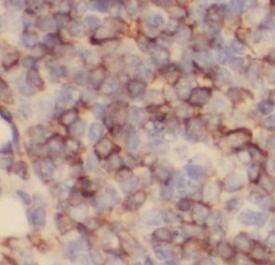 anti- CD20 antibody