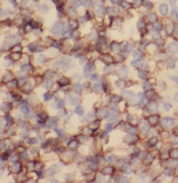 anti- CD20 antibody