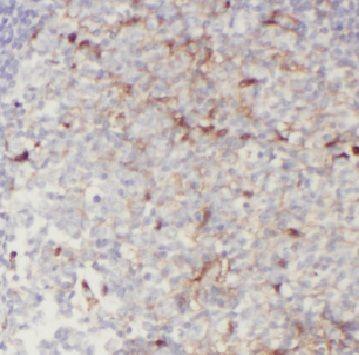 anti- CD244 antibody