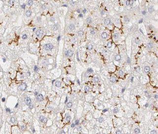 anti- CD36 antibody